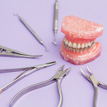Tel tedavisine başlamak için 20 yaş dişlerini çektirmek gerekir mi?